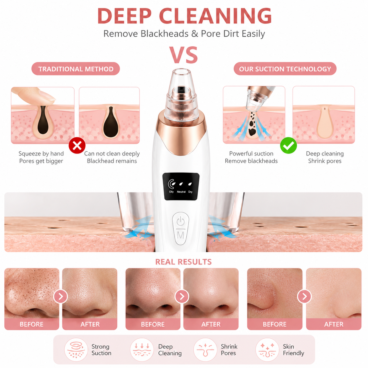 5-in-1 Electric Blackhead Remover
