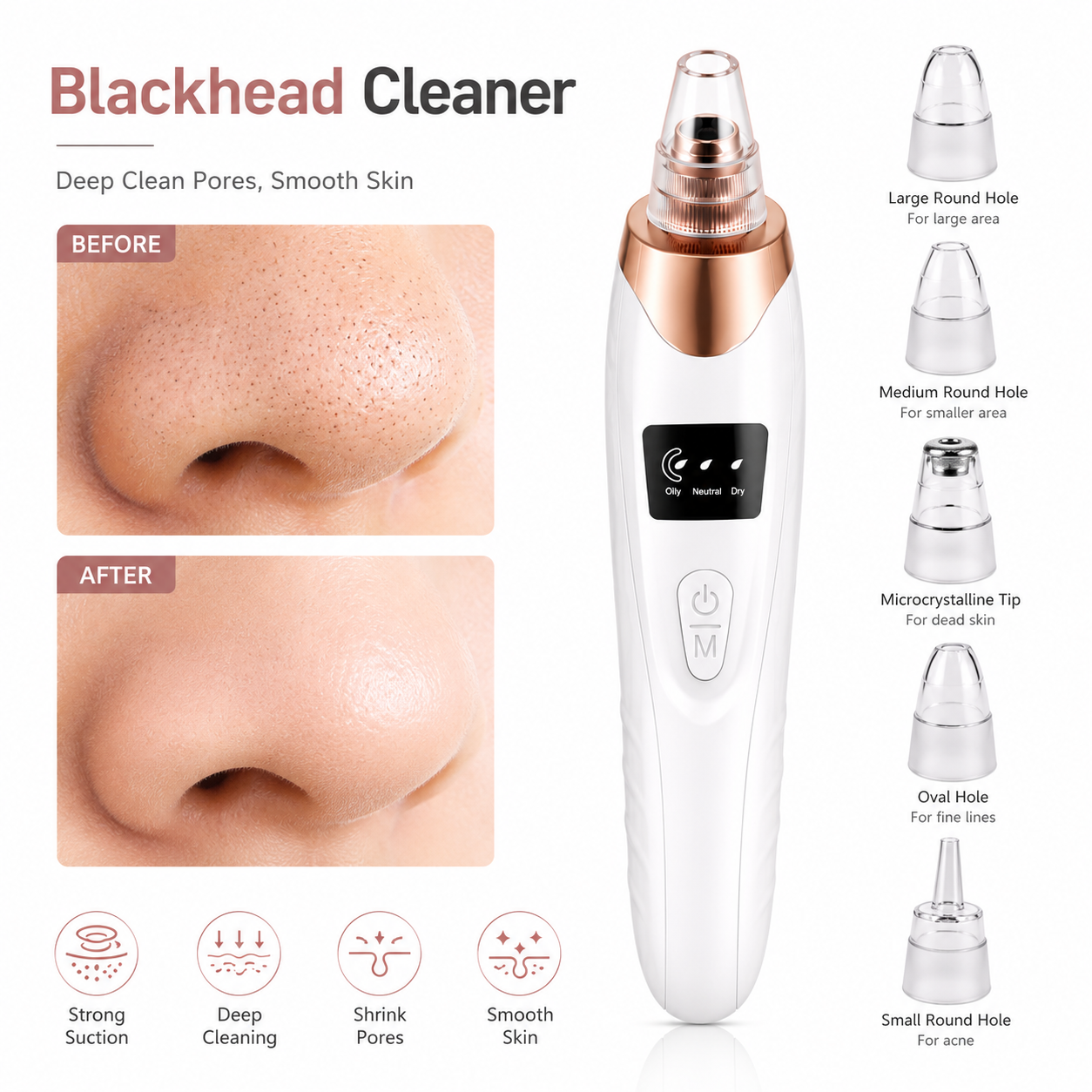 5-in-1 Electric Blackhead Remover