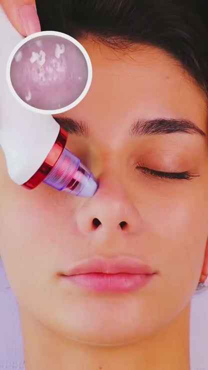 5-in-1 Electric Blackhead Remover